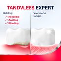Vergelijking van tandvlees: ongezond met roodheid, zwelling, bloeding en gezond met sterke tanden.