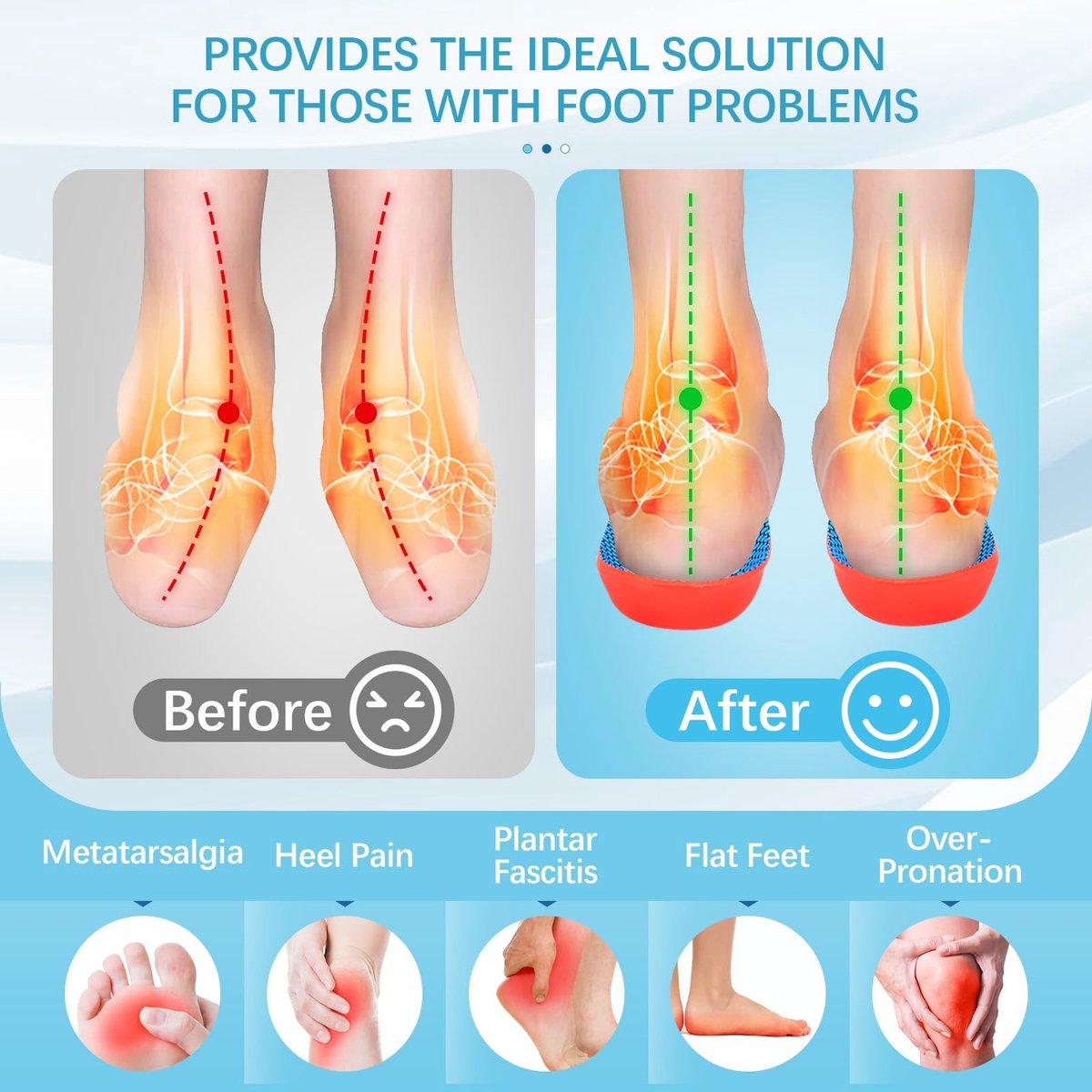 Dailygoody - Plantaire Fasciitis Inlegzolen - Orthopedische Zolen - Comfortabel en Ondersteunend - Geschikt voor Heren - Verlichting van Voetpijn - 2 ...