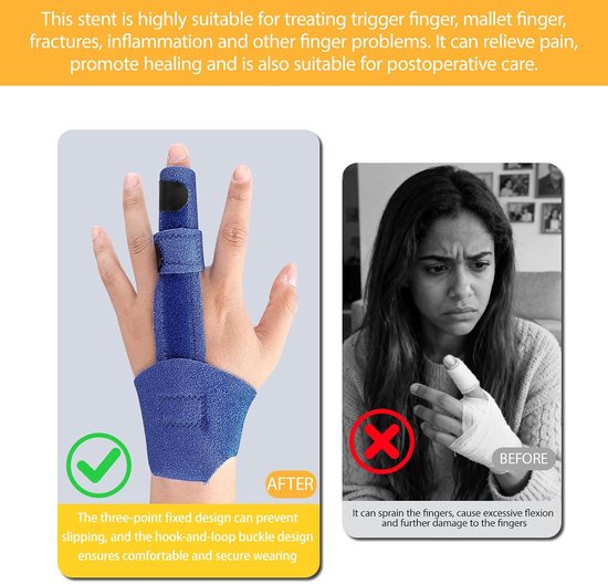 Hand- en Vingerbrace met Metalen Spalk, Zwart, 1 Stuk - Verstelbare Fingerbeugel, Vinger- en Polsondersteuning, Herstel en Pijnverlichting — afbeelding 3
