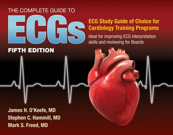 The Complete Guide to ECGs A Comprehensive Study Guide to Improve ECG ...