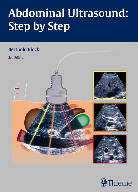 Couverture de livre : "Abdominal Ultrasound: Step by Step" 3e édition, avec une illustration d'une sonde échographique dirigée vers l'abdomen, montrant trois images échographiques d'organes.