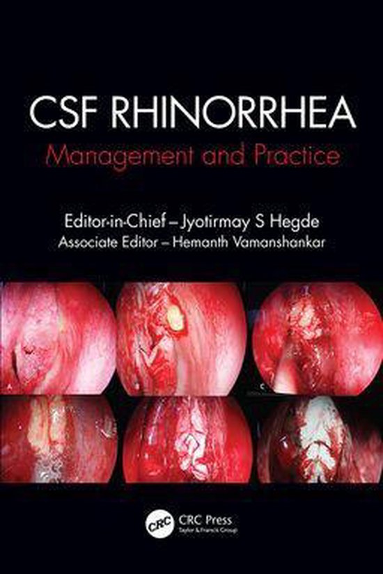 CSF Rhinorrhoea - cover