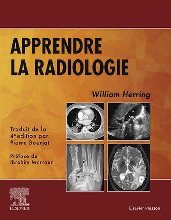 Apprendre la radiologie - cover
