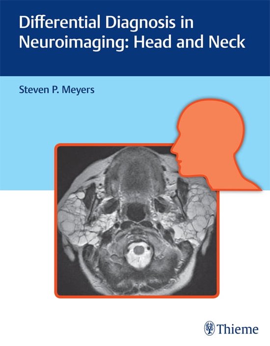 Differential Diagnosis in Neuroimaging Head and Neck (ebook