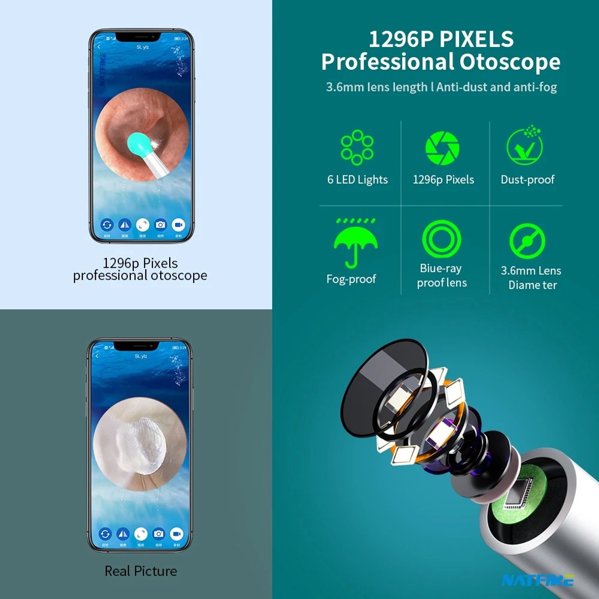 Goedkoopste Oorsmeer Verwijderaar met Camera - Oorreiniger - Ear Cleaner - Oor Schoonmaken - Earscratcher - Oorlepel - Inclusief Reinigingsset - USB Oplaadbaar - Met App