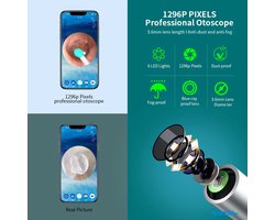 Oorsmeer Verwijderaar met Camera - Oorreiniger - Ear Cleaner - Oor Schoonmaken - Earscratcher - Oorlepel - Inclusief Reinigingsset - USB Oplaadbaar - Met App