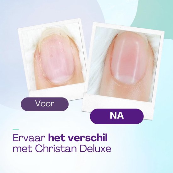 Christian Deluxe® Elektrische Baby Nagelvijl Mint Groen - Baby Nagelknipper - Manicure Set Baby - Nagelschaartje - 6 Vijlen - Incl. Batterij van Christian Deluxe — afbeelding 2