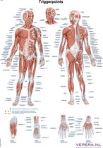 Anatomie poster triggerpoints (Nederlands/Latijn, papier, 50x70 cm) + ophangsysteem
