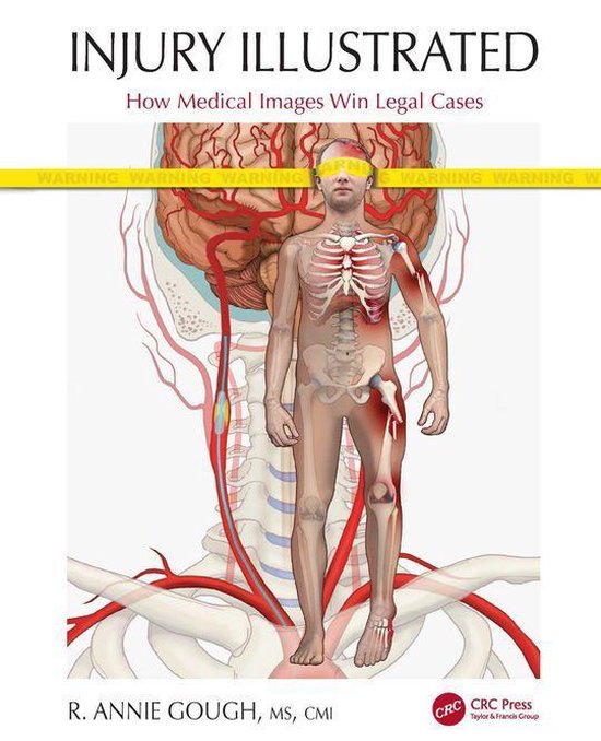 Injury Illustrated - cover