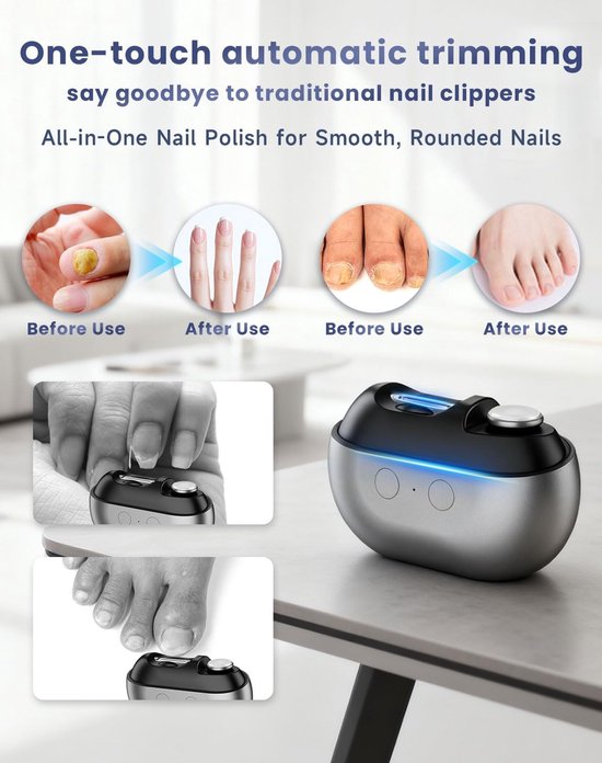 Automatische elektrische nagelknipper met voor-en-na foto's van behandeld hand- en teennagels.