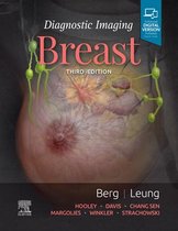 Diagnostic Imaging - Diagnostic Imaging: Breast E-Book
