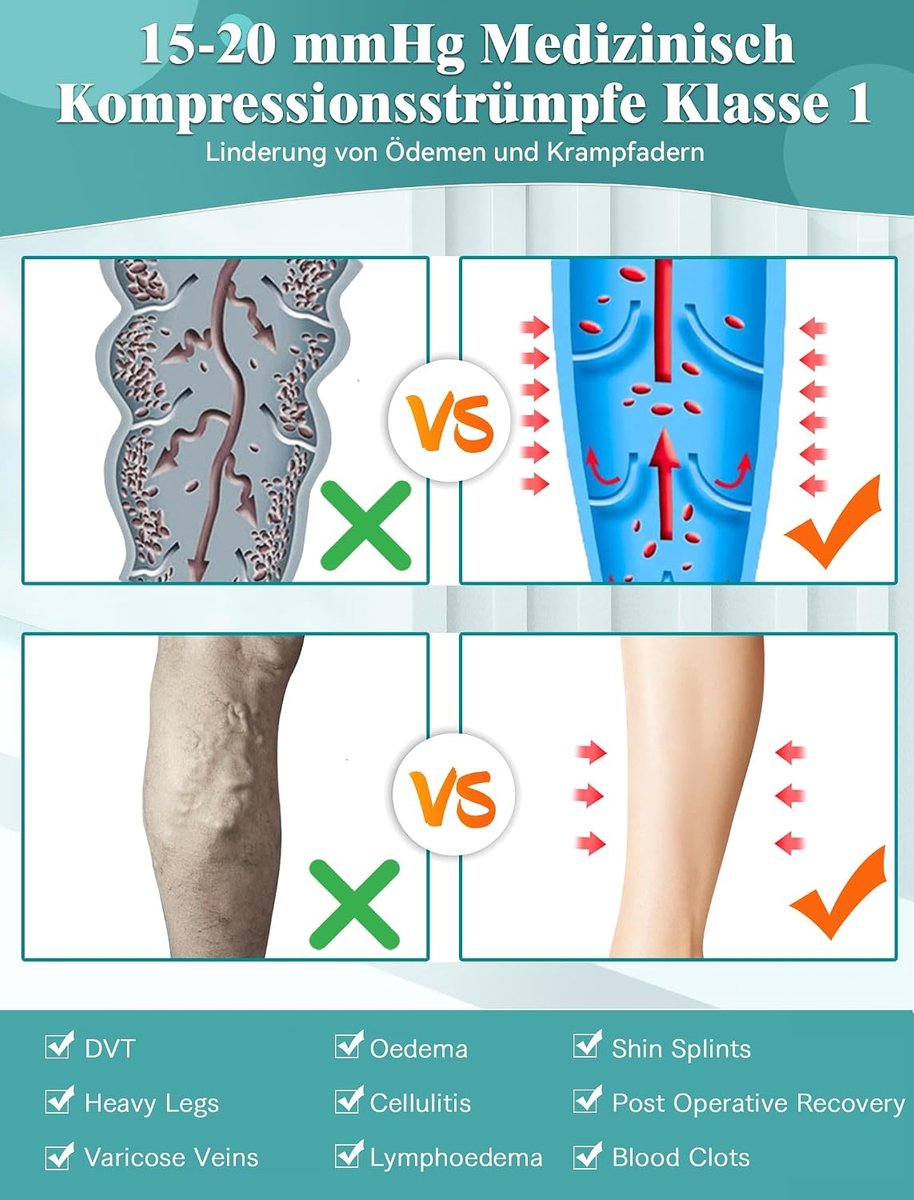 Kousen voor dames en heren, lang, 15-20 mmHg, klasse I, gegradueerde compressiekousen, steunkousen, open teen voor zwangerschap, spataderen, oedeem, lipoedeem