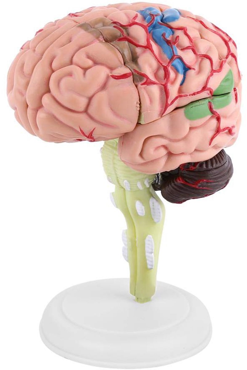 Anatomische Kunst Hersenen Model Medisch Onderwijs Menselijk Hersenen Speelgoed