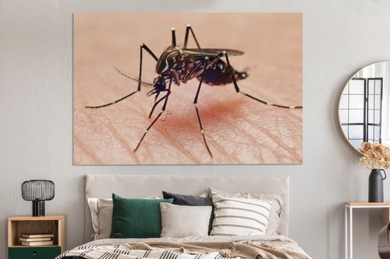 Peintures sur toile - Un moustique pique une main - 150x100 cm - Décoration murale