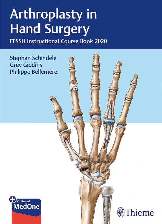 Arthroplasty in Hand Surgery - cover