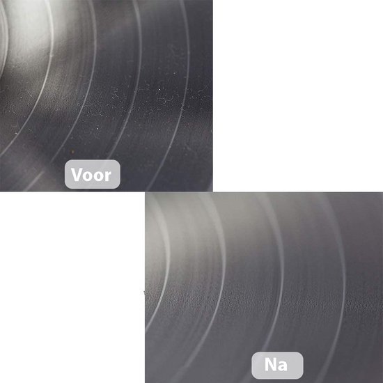 Vicon Professionele 6-in-1 Platenborstel set voor Vinyl Platen - Incl. Naaldreiniger - Antistatisch - Platenreiniger - LP Reinigingsset - LP schoonmaakset - Vinyl reiniger