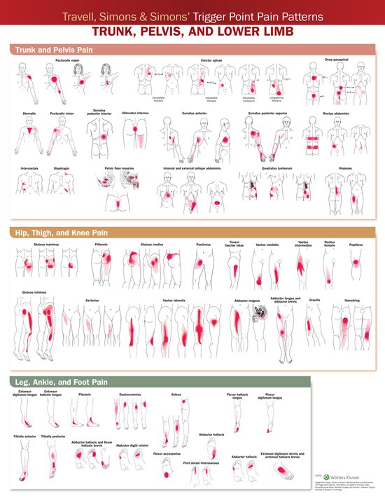 Foto: Travell simons simons trigger point pain patterns wall chart