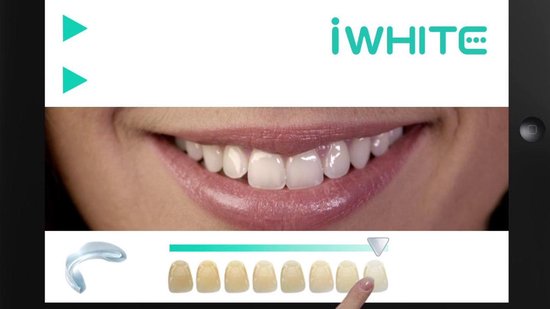 iWhite Instant Whitening Mondwater 500ml - Direct wittere tanden, Lost tandverkleuring op, voor dagelijks gebruik
