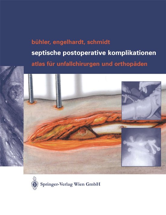 Septische postoperative Komplikationen - cover