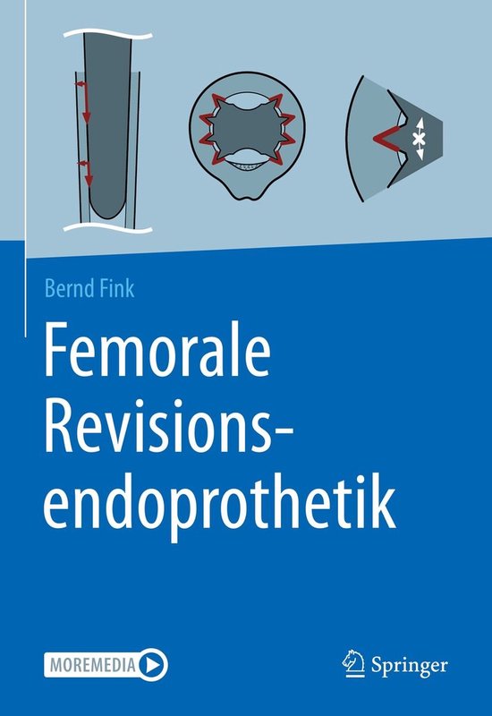 Medicine (German Language) - Femorale Revisionsendoprothetik - cover