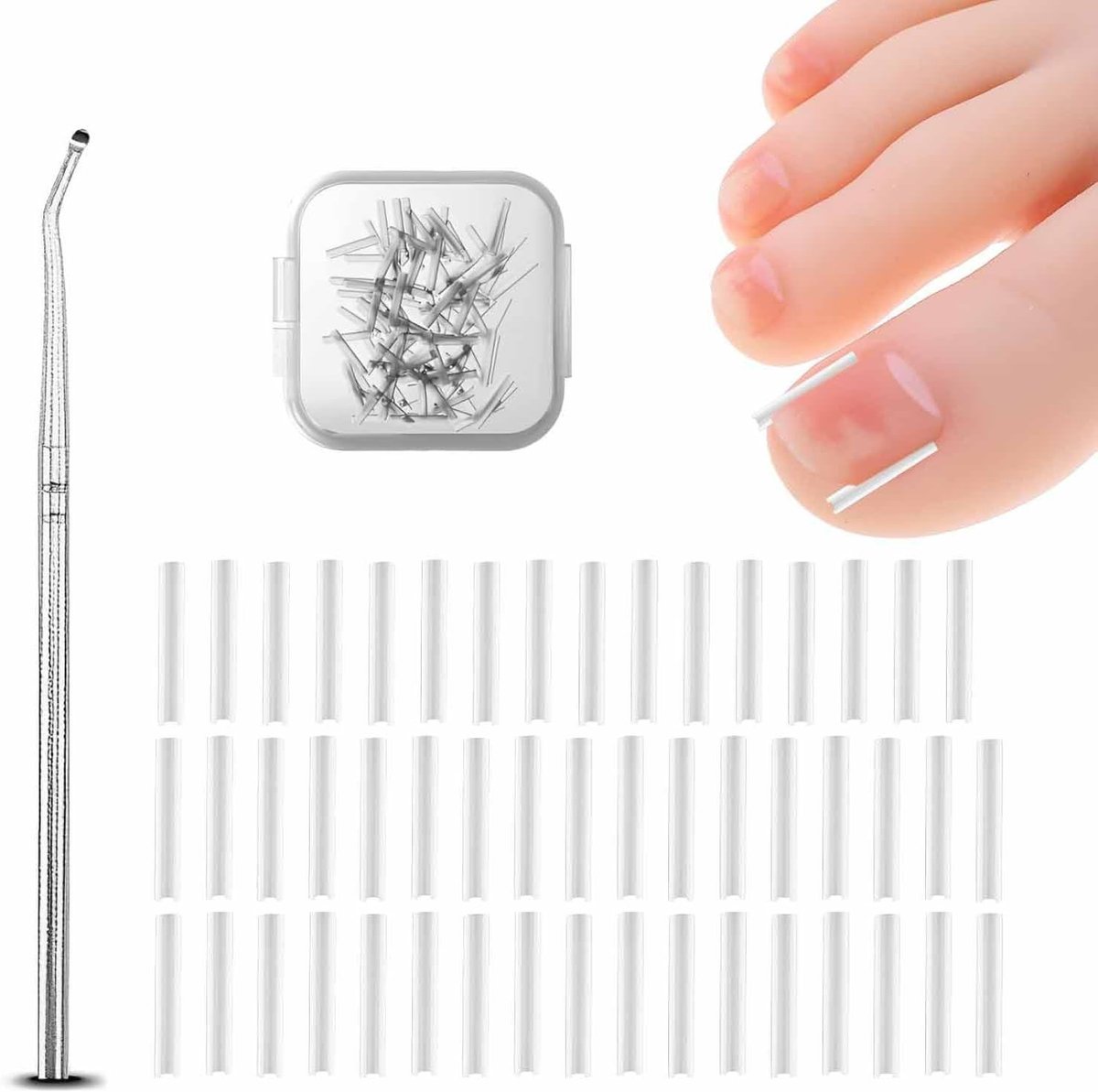 Set voor Correctie van Ingroeiende Teennagels, 50 Stuks, Pijnloze Strips voor Teennagels, Nagelverzorging en Nagelverwijderaar voor Voetverzorging