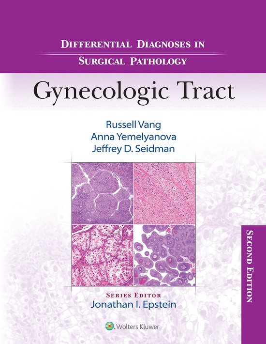 Differential Diagnoses in Surgical Pathology Gynecologic Tract (ebook