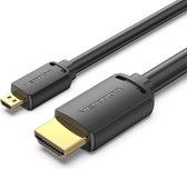 Vention AGIBH, 2 m, HDMI Type D (Micro), HDMI Type A (Standaard), Zwart