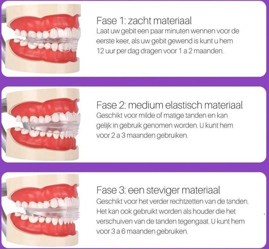 FRSWEQY 0.5M 96-130 Tanden 100 110 120 Tanden Stap Koperen Tandwiel Bolle Rechte Tand 8MM Spiebaan onderdelen 3/3.17/4/5/6/6.35/7/8/10/12MM Gat(4mm,115 Teeth
