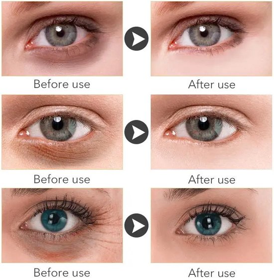 Trstay - Anti aging serum - 92% natuurlijk - Oog serum - Makkelijk te doseren - Snel resultaat - Voor hem of haar