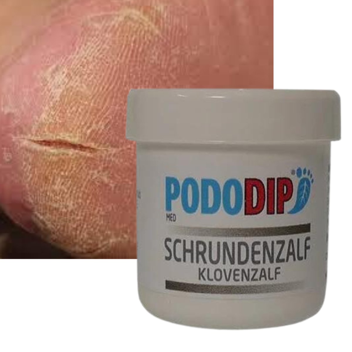 Pododip Klovenzalf - 75 ml - Kloven behandelen - Voetverzorging - Pedicure - Tegen kloven en extreem droge huid