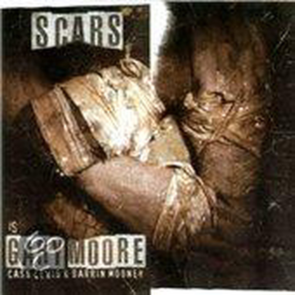 Scars