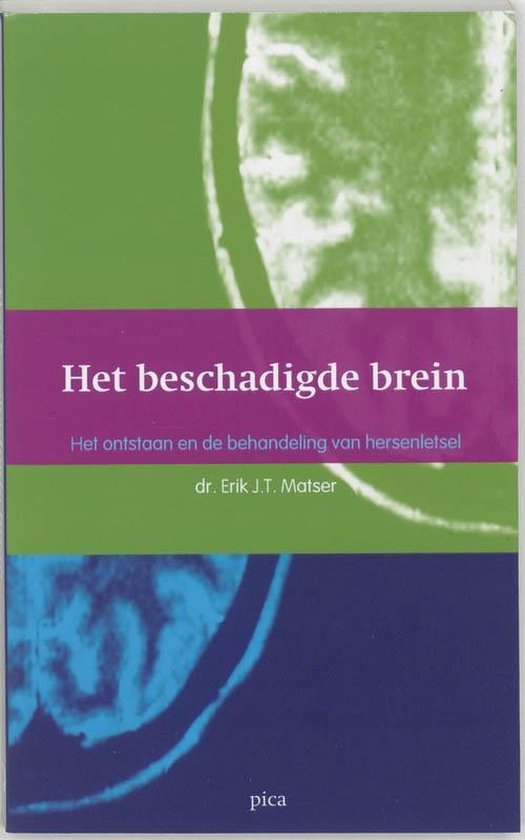 Cover van het boek 'Het beschadigde brein' van E.J.T. Matser
