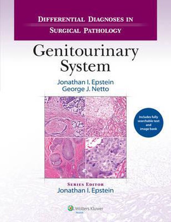 Differential Diagnoses in Surgical Pathology 9781451189582 Jonathan I. Epstein