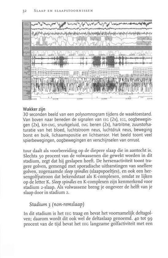 Slaap & Slaapstoornissen