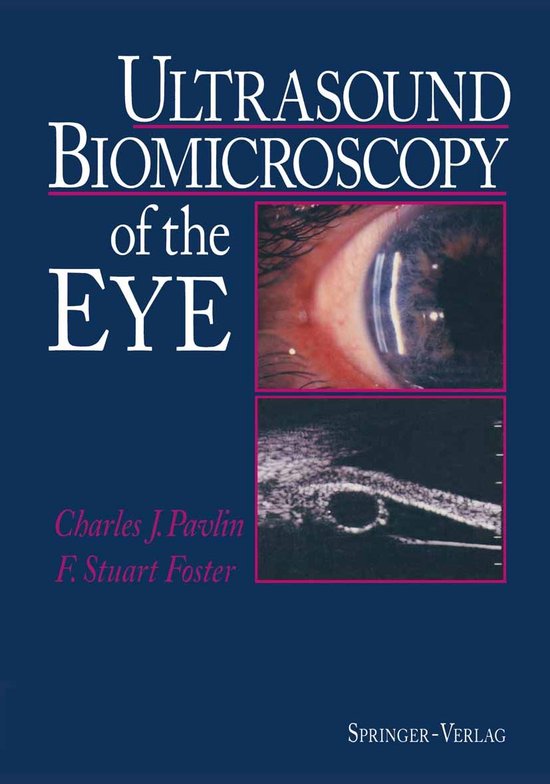 Ultrasound Biomicroscopy of the Eye - cover