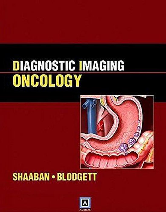 Diagnostic Imaging 9781931884839 Akram M. Shaaban Boeken bol