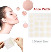 Acne patches - 8mm - 10mm - 12mm