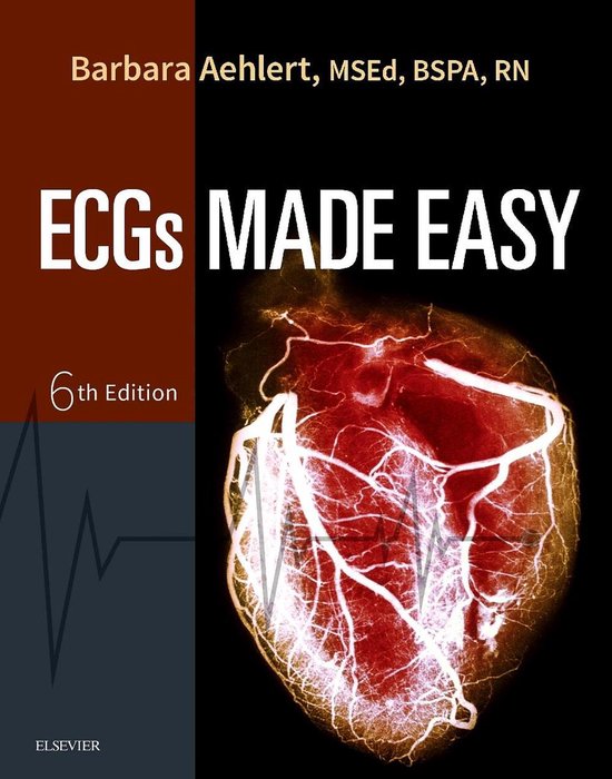 Complete Test Bank ECGs Made Easy 6th Edition Barbara Questions & Answers with rationales (Chapter 1-10)