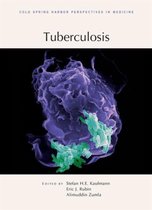 Tuberculosis