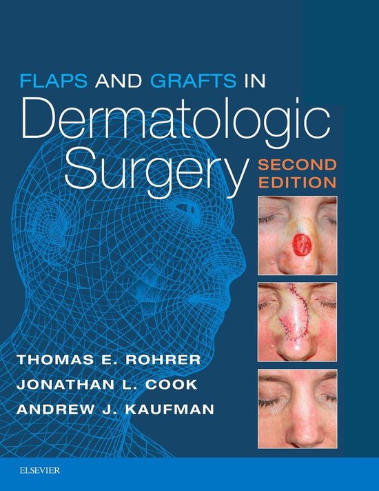Flaps and Grafts in Dermatologic Surgery E-Book - cover