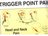 Travell and Simons' Trigger Point Pain Patterns Wall Charts