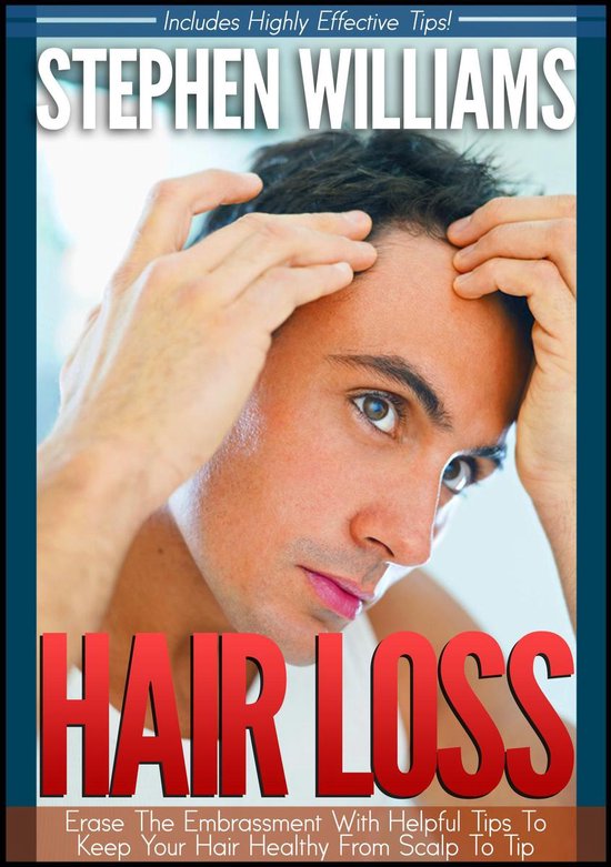 Hair Loss: Erase The Embrassment With Helpful Tips To Keep Y ... - cover