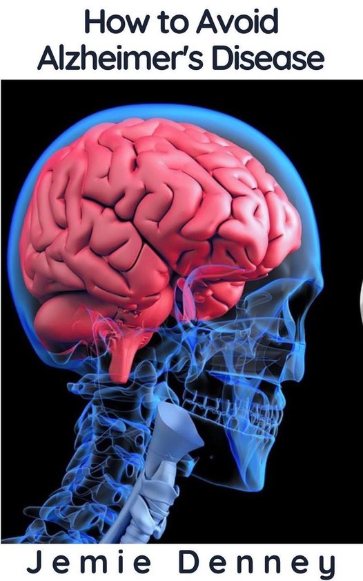 How to Avoid Alzheimer's Disease - cover