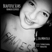 Beautiful Scars Hermosas Cicatrices