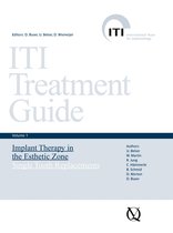ITI Treatment Guide Series 1 - Implant Therapy in the Esthetic Zone