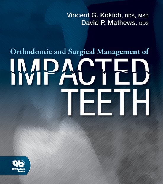 Foto: Orthodontic and surgical management of impacted teeth