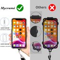 Vergelijking van telefoonhoesjes: links een doorzichtig hoesje met lanyard, rechts een hoesje met telefoonkoordsysteem.