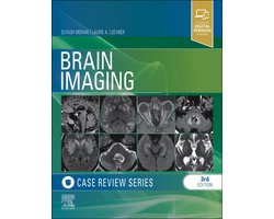 Brain Imaging Case Review Series