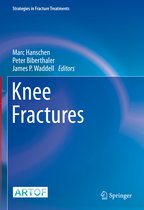Strategies in Fracture Treatments- Knee Fractures