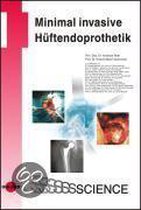 Minimal invasive Hüftendoprothetik